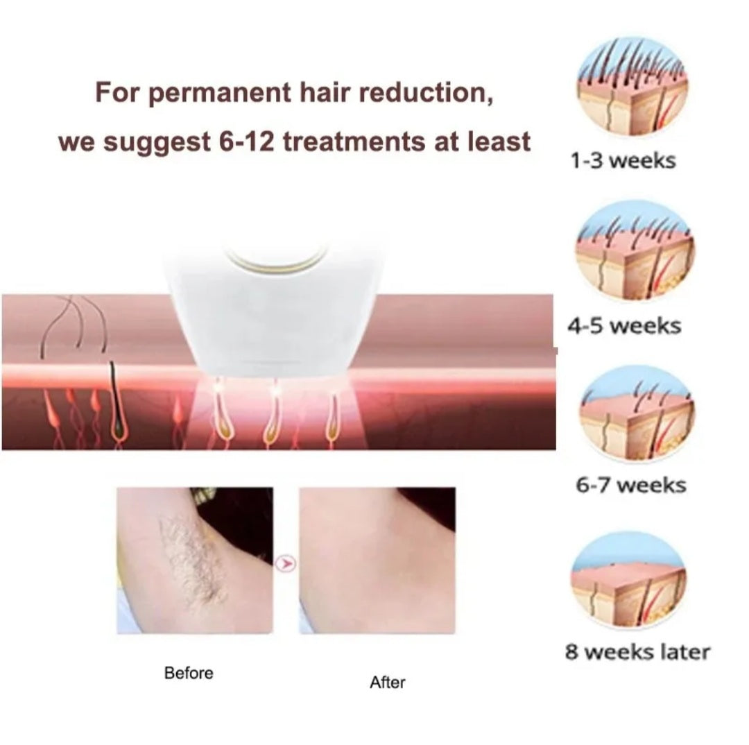 IPL Laser Hair Removal Handset System for Women & Men